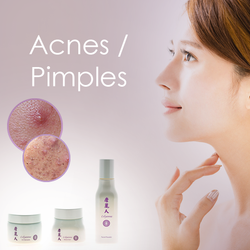 Acnes & Pimples Treatment